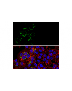 Cell Signaling Apoe (Pan) (D7i9n) Rabbit mAb