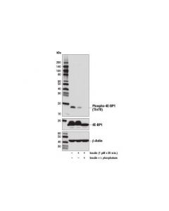 Cell Signaling Phospho-4e-Bp1 (Thr70) (D7f6i) Rabbit mAb