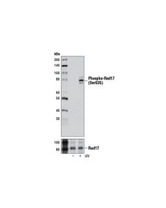 Cell Signaling Phospho-Rad17 (Ser635) (D6k9p) Rabbit mAb