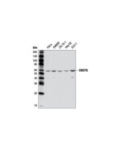 Cell Signaling Cnot6 (E1l8f) Rabbit mAb