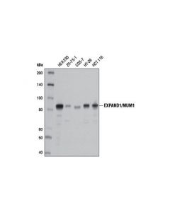 Cell Signaling Expand1/Mum1 (D1z6y) Rabbit mAb