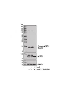 Cell Signaling Phospho-4e-Bp1 (Ser65) (D9g1q) Rabbit mAb