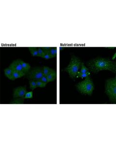 Cell Signaling Atg13 (E1y9v) Rabbit mAb