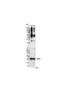 Cell Signaling Asymmetric Di-Methyl Arginine Motif [Adme-R] Multimab Rabbit mAb Mix