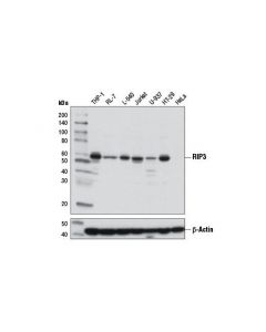 Cell Signaling Rip3 (E1z1d) Rabbit mAb