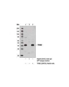 Cell Signaling Trib2 (D8p2x) Rabbit mAb