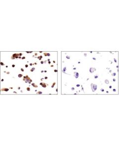 Cell Signaling Prolactin Receptor (D4a9) Rabbit mAb