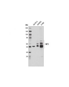 Cell Signaling Wt1 (D6m6s) Rabbit mAb
