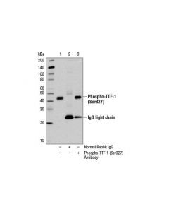 Cell Signaling Phospho-Ttf-1 (Ser327) Antibody