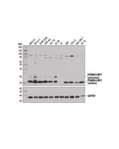 Cell Signaling Psmb8/Lmp7 (D1k7x) Rabbit mAb