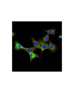 Cell Signaling Stathmin (D1y5a) Rabbit mAb