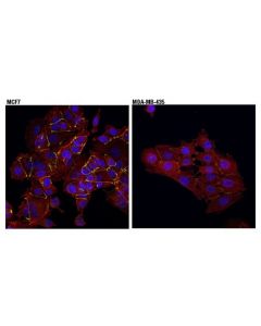 Cell Signaling Zo-1 (D6l1e) Rabbit mAb