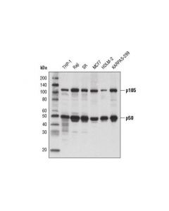 Cell Signaling Nf-Kappab1 P105/P50 (5d10d11) Mouse mAb
