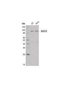 Cell Signaling Suz12 (D39f6) Xp  Rabbit mAb (Biotinylated)