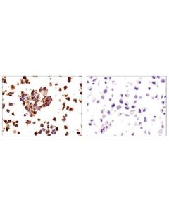 Cell Signaling Signalslide  Pd-L1 Ihc Controls