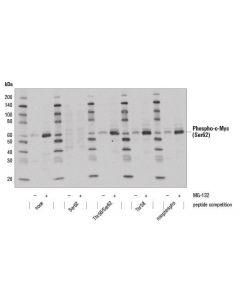 Cell Signaling Phospho-C-Myc (Ser62) (E1j4k) Rabbit mAb