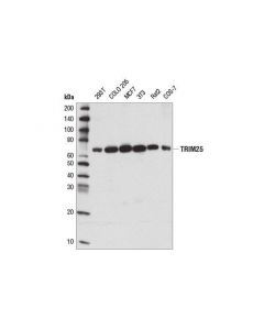 Cell Signaling Trim25 (D9t7g) Rabbit mAb
