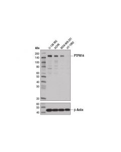 Cell Signaling Ptpn14 (D5t6y) Rabbit mAb