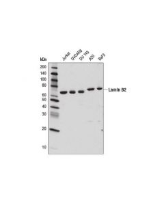 Cell Signaling Lamin B2 (E1s1q) Rabbit mAb