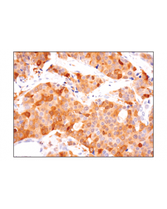 Cell Signaling Asc/Tms1 (E1e3i) Rabbit mAb