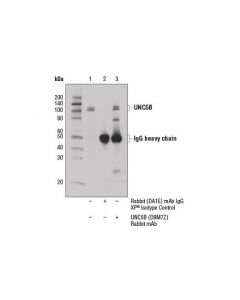 Cell Signaling Unc5b (D9m7z) Rabbit mAb