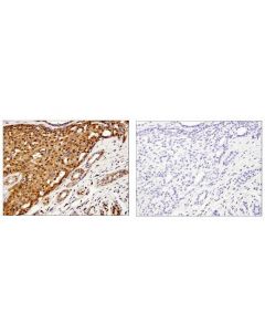 Cell Signaling Galectin-1/Lgals1 (D608t) Rabbit mAb (Ihc Formulated)