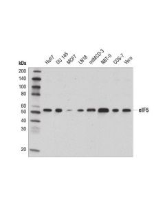 Cell Signaling Eif5 (D5g9) Rabbit mAb