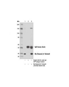 Cell Signaling Na Channel Beta1 Subunit (D4z2n) Rabbit mAb