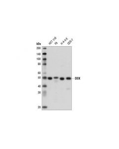 Cell Signaling Dek (E1l3v) Rabbit mAb