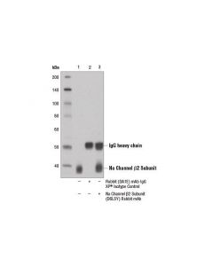 Cell Signaling Na Channel Beta2 Subunit (D6l5y) Rabbit mAb