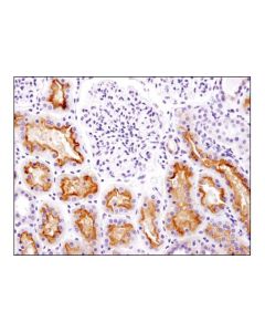 Cell Signaling Mdr1/Abcb1 (E1y7s) Rabbit mAb