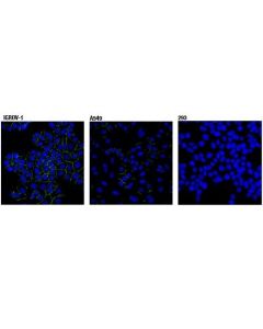 Cell Signaling Claudin-1 (D3h7c) Rabbit mAb