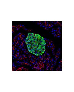 Cell Signaling Pc2 (D1e1s) Xp Rabbit mAb