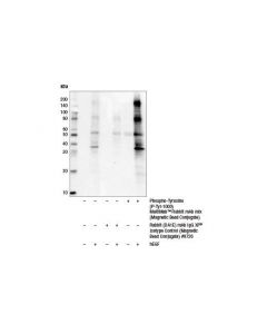 Cell Signaling Phospho-Tyrosine (P-Tyr-1000) Multimab Rabbit mAb Mix (Magnetic Bead Conjugate)