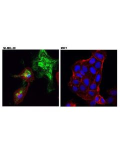 Cell Signaling Prnp (D3q5c) Rabbit mAb