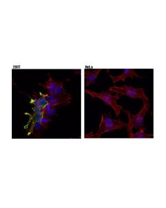 Cell Signaling Gpr50 (D1d6i) Rabbit mAb