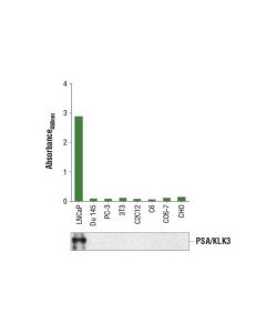 Cell Signaling Pathscan  Total Psa/Klk3 Sandwich Elisa Kit