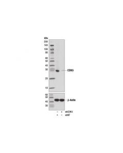 Cell Signaling Cdk5 (D1f7m) Rabbit mAb