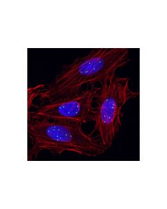 Cell Signaling Coilin (D2l3j) Xp Rabbit mAb