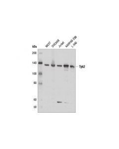 Cell Signaling Tyk2 (D4i5t) Rabbit mAb