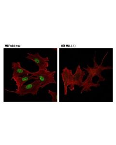 Cell Signaling Mll1 (D6g8n) Rabbit mAb (Carboxy-Terminal Antigen)
