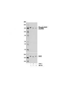 Cell Signaling Phospho-Ulk1 (Ser638) (D8k9o) Rabbit mAb