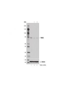 Cell Signaling Tab3 (D5j7d) Rabbit mAb