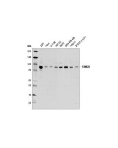 Cell Signaling Fancb (D9w6s) Rabbit mAb
