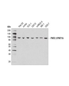 Cell Signaling Patl1/Pat1b (D8p1b) Rabbit mAb
