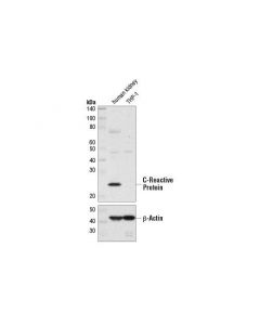 Cell Signaling C-Reactive Protein (D1n1u) Rabbit mAb