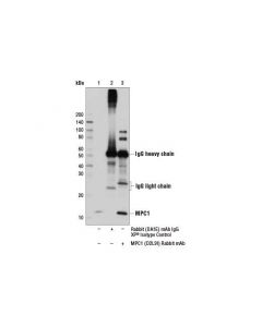 Cell Signaling Mpc1 (D2l9i) Rabbit mAb