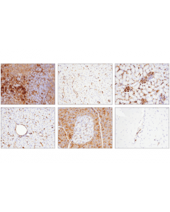 Cell Signaling Cd39/Ntpdase 1 (E2x6b) Xp Rabbit mAb (Mouse Specific)