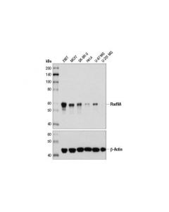 Cell Signaling Rad9a (D2j4p) Rabbit mAb