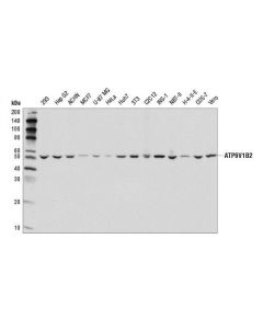 Cell Signaling Atp6v1b2 (D3o7q) Rabbit mAb